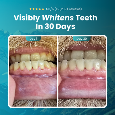 MedYouth | Remineralizing Gum